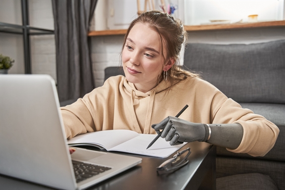 Woman with prosthesis arm writing at notebook